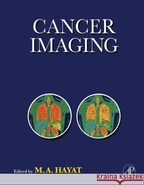 Cancer Imaging: Lung and Breast Carcinomas Hayat, M. A. 9780123704689 Academic Press