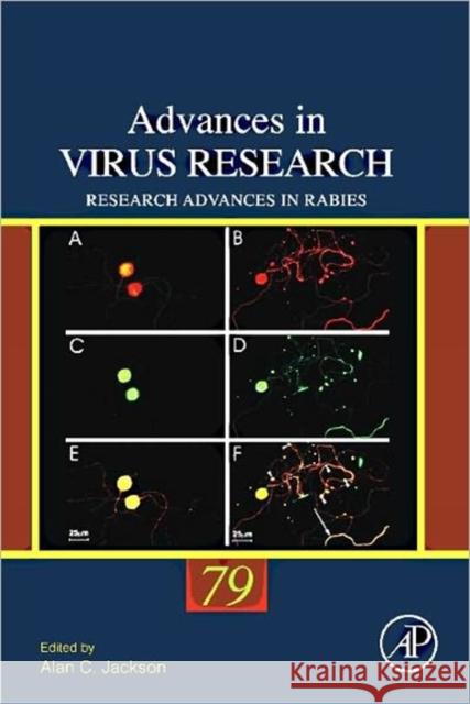 Research Advances in Rabies: Volume 79 Jackson, Alan C. 9780123870407 Academic Press