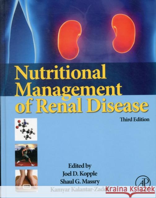 Nutritional Management of Renal Disease Kopple, Joel D., Massry, Shaul G, Kalantar-Zadeh, Kamyar 9780123919342 Academic Press