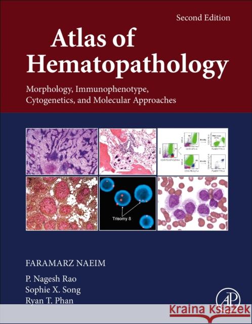 Atlas of Hematopathology: Morphology, Immunophenotype, Cytogenetics, and Molecular Approaches Naeim, Faramarz 9780128098431 