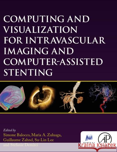 Computing and Visualization for Intravascular Imaging and Computer-Assisted Stenting Balocco Simone Maria A. Zuluaga Guillaume Zahnd 9780128110188 Academic Press
