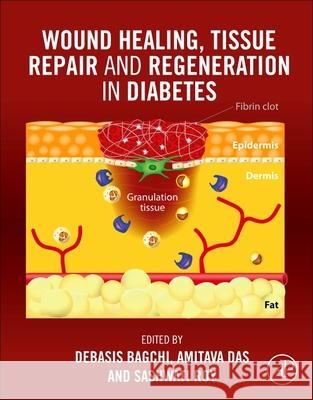 Wound Healing, Tissue Repair and Regeneration in Diabetes Debasis Bagchi Sashwati Roy Amitava Das 9780128164136