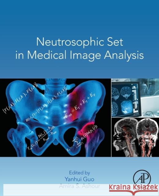 Neutrosophic Set in Medical Image Analysis Yanhui Guo Amira Salah Ashour 9780128181485