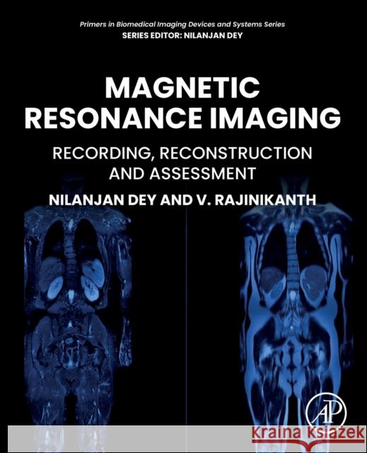 Magnetic Resonance Imaging: Recording, Reconstruction and Assessment Rajinikanth V Nilanjan Dey 9780128234013