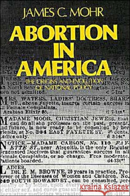 Abortion in America: The Origins and Evolution of National Policy, 1800-1900 Mohr, James C. 9780195026160 Oxford University Press
