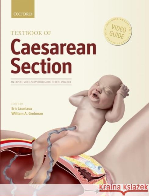 Textbook of Caesarean Section Eric Jauniaux 9780198758563