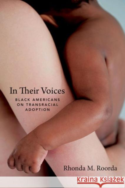 In Their Voices: Black Americans on Transracial Adoption Rhonda M. Roorda 9780231172219 Columbia University Press