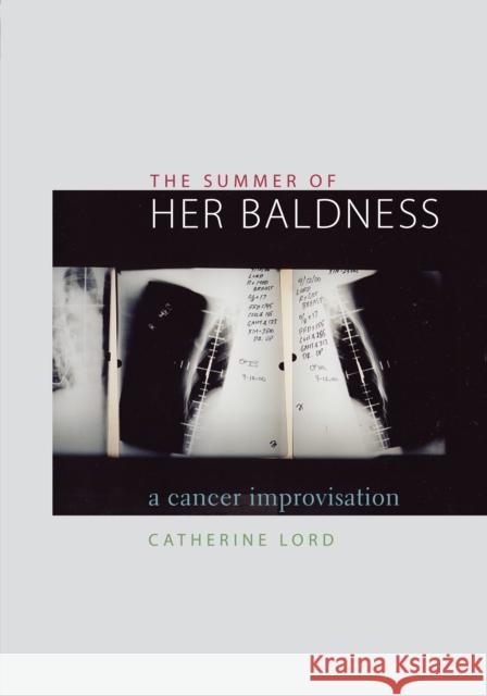 The Summer of Her Baldness: A Cancer Improvisation Lord, Catherine 9780292702578 University of Texas Press