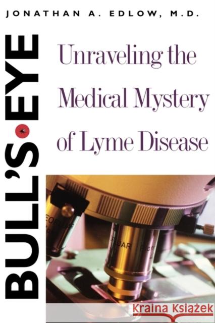 Bull's-Eye: Unraveling the Medical Mystery of Lyme Disease Edlow, Jonathan A. 9780300103700 Yale University Press