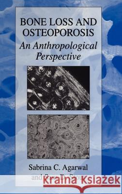 Bone Loss and Osteoporosis: An Anthropological Perspective Agarwal, Sabrina C. 9780306477676