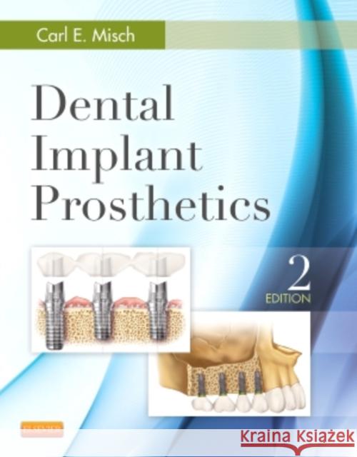 Dental Implant Prosthetics Carl E. Misch 9780323078450 Mosby