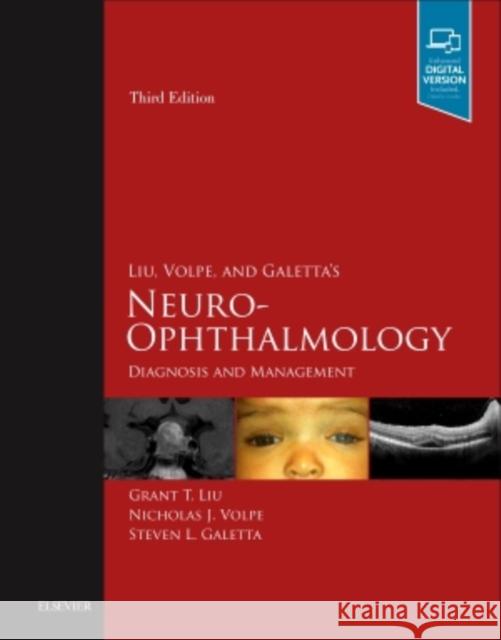 Liu, Volpe, and Galetta's Neuro-Ophthalmology: Diagnosis and Management Liu, Grant T. 9780323340441 Elsevier