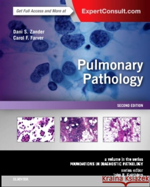 Pulmonary Pathology: A Volume in the Series: Foundations in Diagnostic Pathology Zander, Dani S. 9780323393089 Elsevier