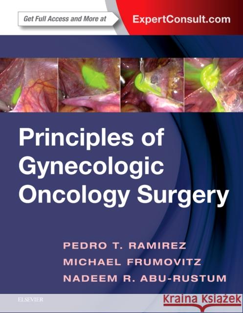 Principles of Gynecologic Oncology Surgery Pedro T. Ramirez Michael Frumovitz Nadeem R. Abu-Rustum 9780323428781 Elsevier