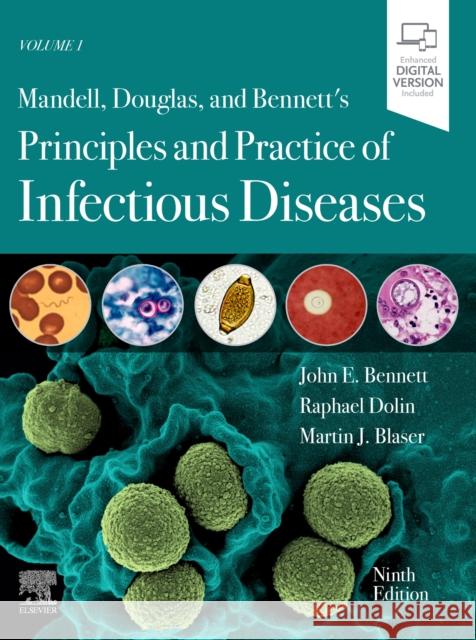 Mandell, Douglas, and Bennett's Principles and Practice of Infectious Diseases: 2-Volume Set John E. Bennett Raphael Dolin Martin J. Blaser 9780323482554