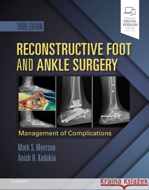 Reconstructive Foot and Ankle Surgery: Management of Complications Myerson, Mark S. 9780323496933