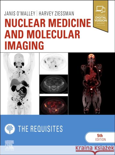 Nuclear Medicine and Molecular Imaging: The Requisites Janis P. O'Malley Harvey A. Ziessman James H. Thrall, M.D. 9780323530378