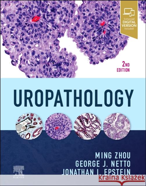Uropathology Ming Zhou George Netto Jonathan I. Epstein 9780323653954