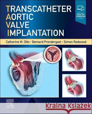 Transcatheter Aortic Valve Implantation Catherine M. Otto (J. Ward Kennedy-Hamil Bernard D Prendergast, MD (Department of Simon Redwood (Department of Cardiolog 9780323757928