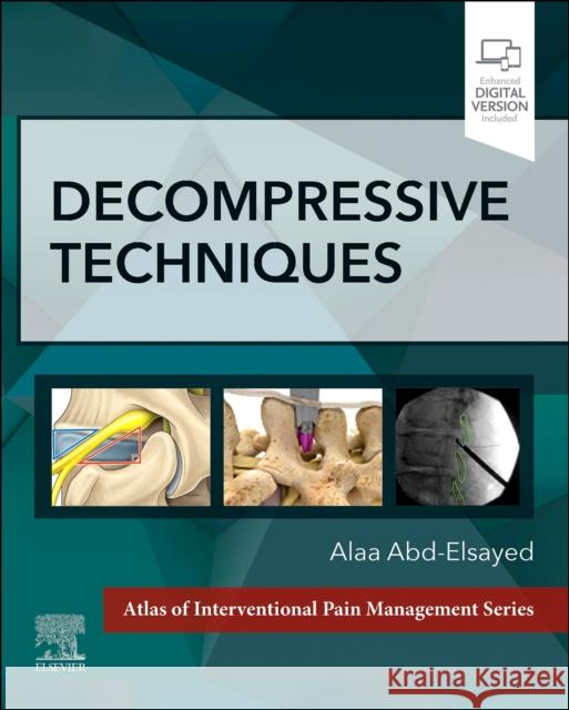 Decompressive Techniques Alaa Abd-Elsayed 9780323877510 Elsevier - Health Sciences Division