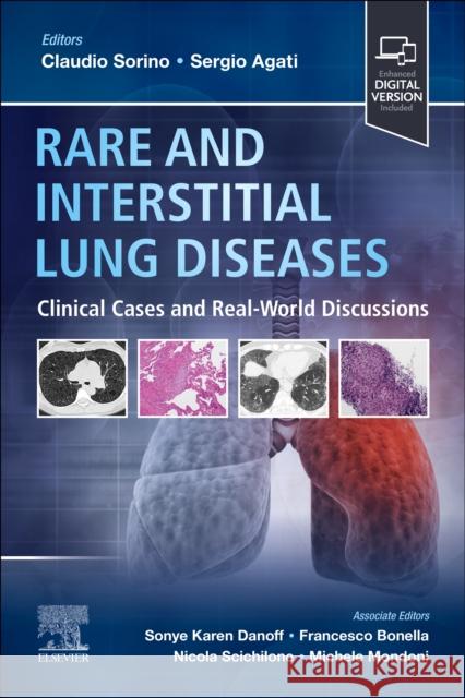 Rare and Interstitial Lung Diseases: Clinical Cases and Real-World Discussions Claudio Sorino Sergio Agati 9780323935227 Elsevier