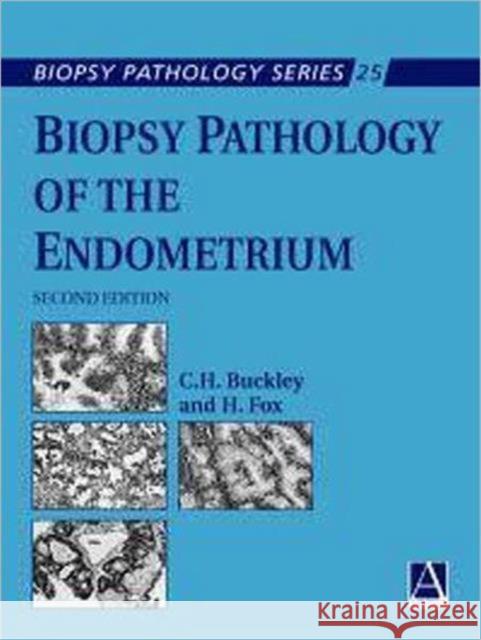 Biopsy Pathology of the Endometrium, 2ed Buckley, Hilary 9780340807064 0