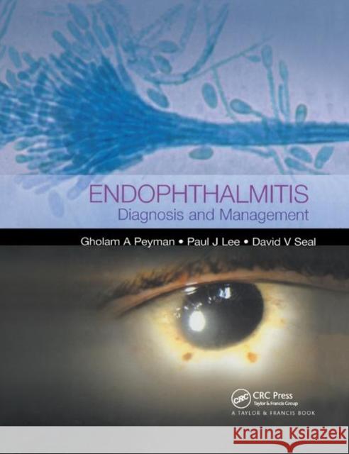 Endophthalmitis: Diagnosis and Treatment Paul J. Lee (Retina Consultants of Weste David V. Seal (London, UK) Gholam A. Peyman (University of Arizona  9780367393618