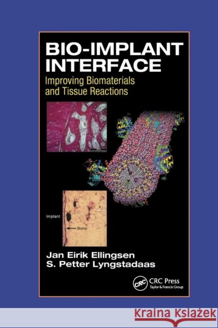 Bio-Implant Interface: Improving Biomaterials and Tissue Reactions J. E. Ellingsen S. P. Lyngstadaas 9780367395230 CRC Press