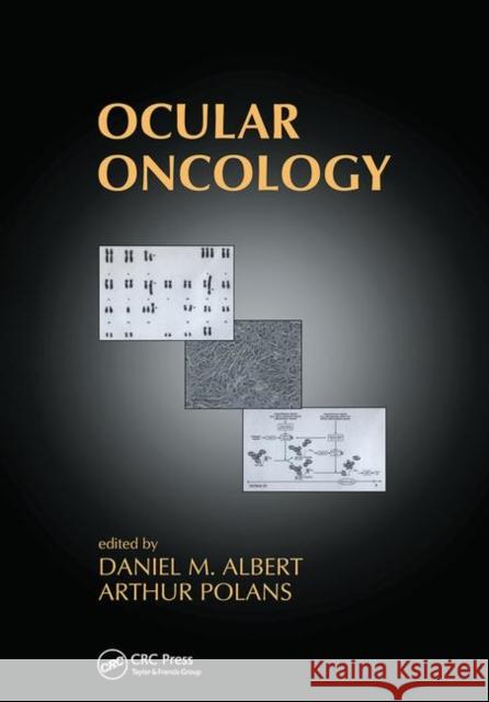Ocular Oncology Daniel M. Albert Arthur Polans 9780367446673 CRC Press