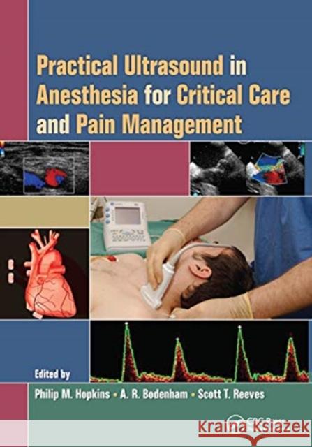 Practical Ultrasound in Anesthesia for Critical Care and Pain Management Philip M. Hopkins Andrew R. Bodenham Scott T. Reeves 9780367452544