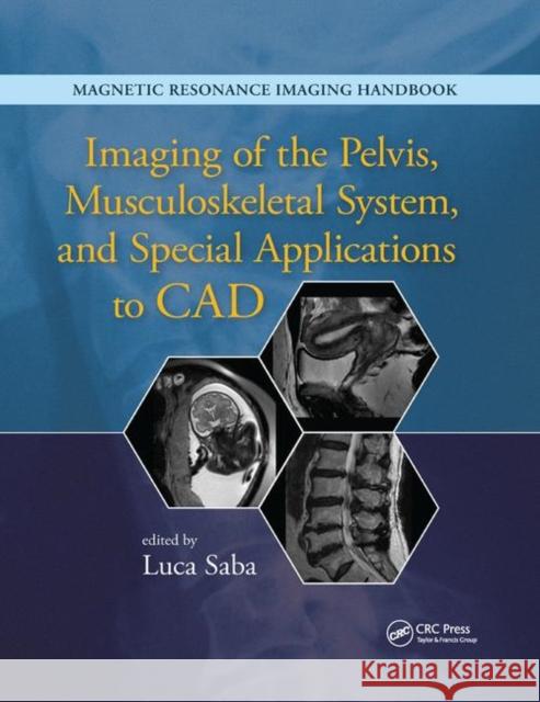 Imaging of the Pelvis, Musculoskeletal System, and Special Applications to CAD Luca Saba 9780367868901