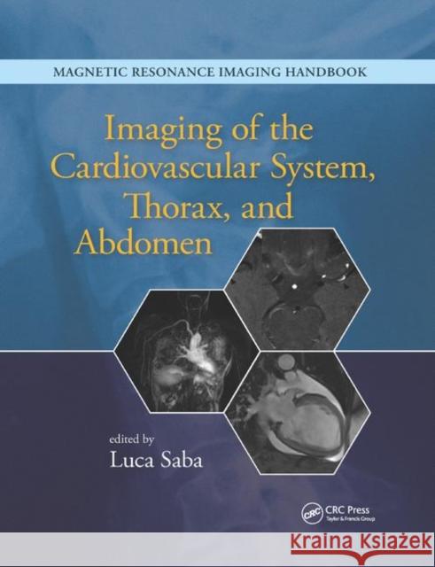 Imaging of the Cardiovascular System, Thorax, and Abdomen Luca Saba 9780367868918