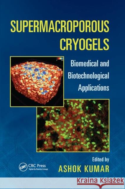 Supermacroporous Cryogels: Biomedical and Biotechnological Applications Ashok Kumar 9780367869472 CRC Press