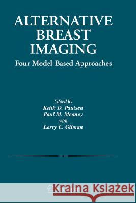 Alternative Breast Imaging: Four Model-Based Approaches Paulsen, Keith D. 9780387233635 Springer