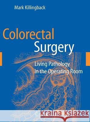 Colorectal Surgery: Living Pathology in the Operating Room Killingback, Mark 9780387290812 Springer