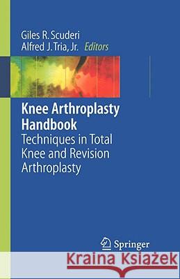 Knee Arthroplasty Handbook: Techniques in Total Knee and Revision Arthroplasty Scuderi, Giles R. 9780387307305 Springer