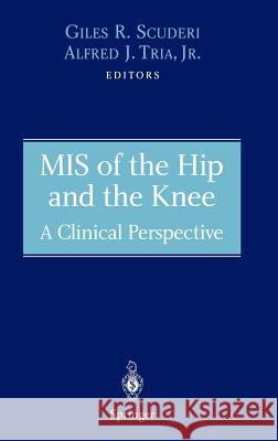 MIS of the Hip and the Knee: A Clinical Perspective Scuderi, Giles R. 9780387403533 Springer