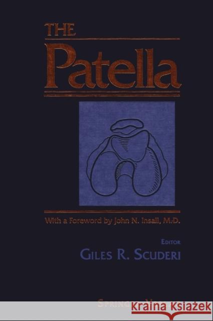 The Patella Giles R. Scuderi Giles R. Scuderi L. V. Kibiuk 9780387943718 Springer Us