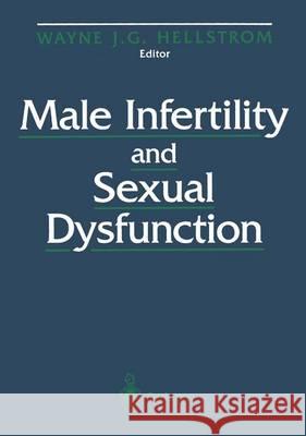 Male Infertility and Sexual Dysfunction Wayne J. Hellstrom 9780387948591 Springer