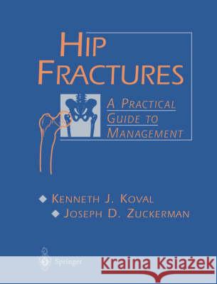 Hip Fractures: A Practical Guide to Management Kenneth J. Koval Joseph D. Zuckerman 9780387983875 Springer