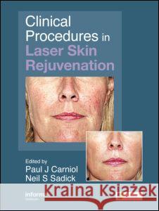 Clinical Procedures in Laser Skin Rejuvenation Paul Carniol Neil S. Sadick 9780415414135