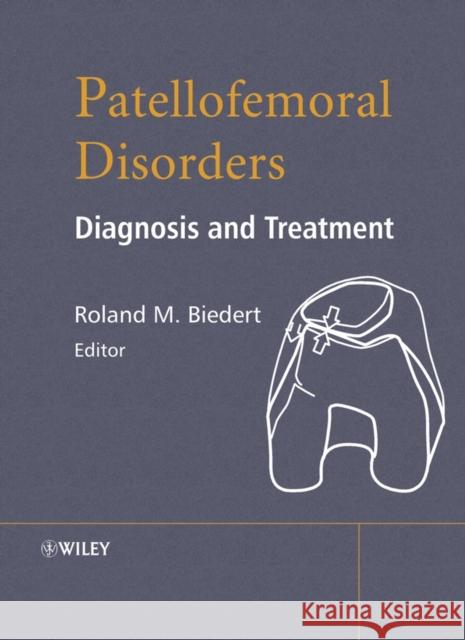 Patellofemoral Disorders: Diagnosis and Treatment Biedert, Roland M. 9780470850114 John Wiley & Sons
