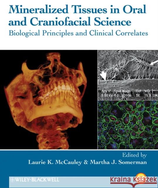 Mineralized Tissues in Oral and Craniofacial Science: Biological Principles and Clinical Correlates McCauley, Laurie K. 9780470958339 Wiley-Blackwell
