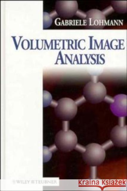 Volumetric Image Analysis Gabriele Lohmann Lohmann 9780471967859 John Wiley & Sons