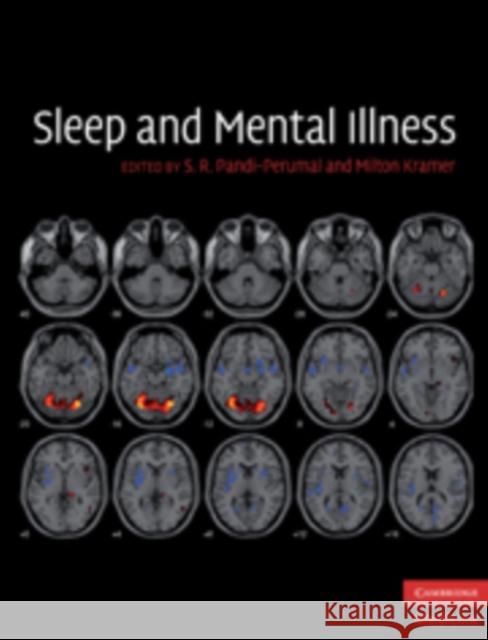 Sleep and Mental Illness S R Pandi-Perumal 9780521110501 0