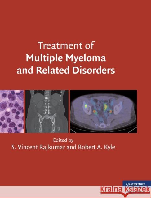 Treatment of Multiple Myeloma and Related Disorders S Vincent Rajkumar 9780521515030 0