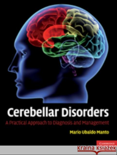 Cerebellar Disorders: A Practical Approach to Diagnosis and Management Manto, Mario Ubaldo 9780521878135