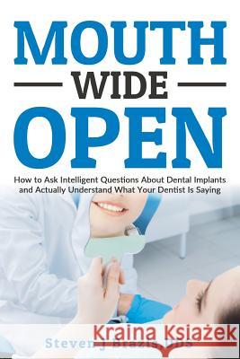 Mouth Wide Open: How To Ask Intelligent Questions About Dental Implants and Actually Understand What Your Dentist Is Saying Brazis Dds, Steven J. 9780692728406 Steven J Brazis, Dds
