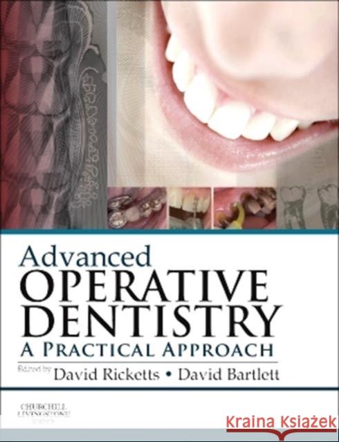 Advanced Operative Dentistry: A Practical Approach Ricketts, David 9780702055386 Churchill Livingstone