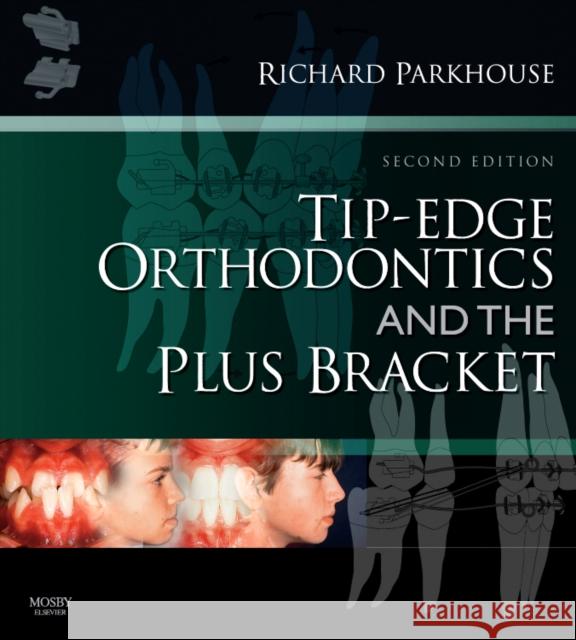 Tip-Edge Orthodontics and the Plus Bracket Richard Parkhouse 9780723434818 Mosby